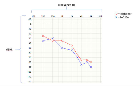 Understanding the degrees of hearing loss | NewSound Hearing Centers